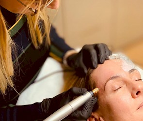 Huidoneffenheden verwijderen