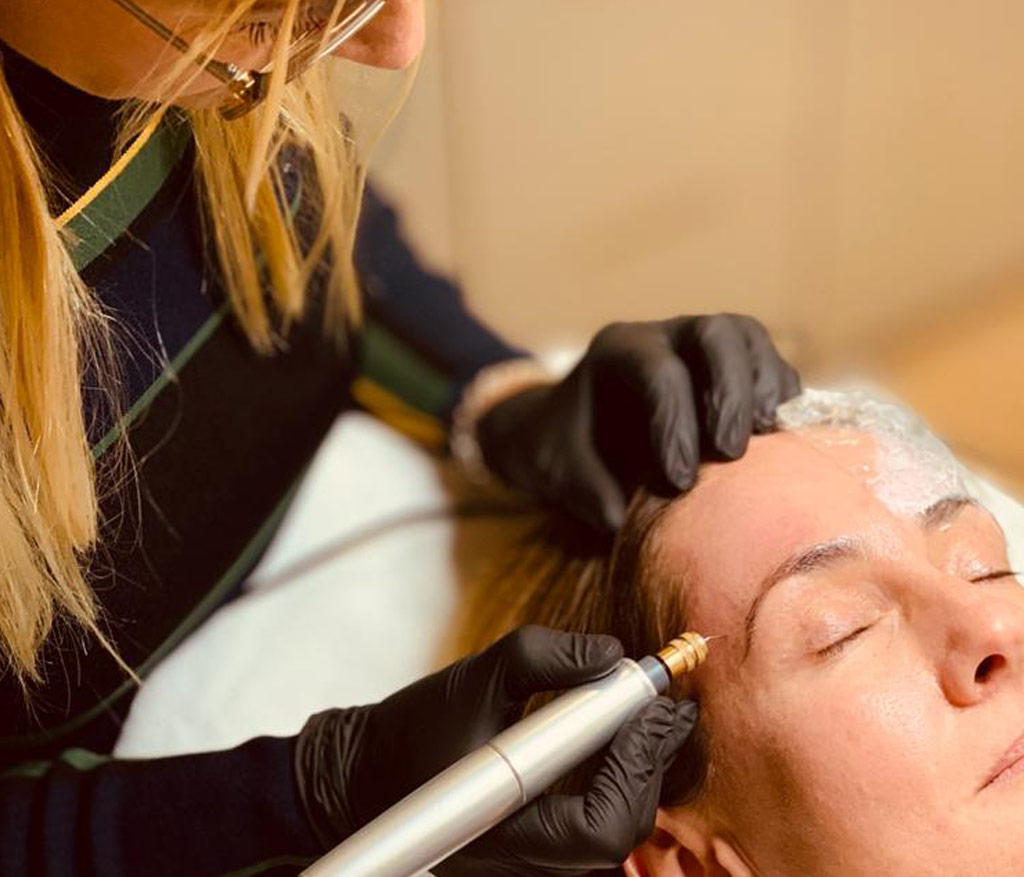 Huidoneffenheden verwijderen