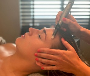 Dermapen behandeling