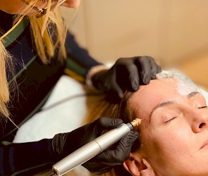 Rimpels en striae behandeling