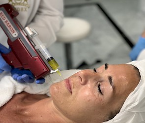 Cosmetische Mesotherapie