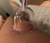 Cupping massage